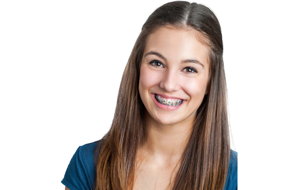 PROPEL to Decrease Orthodontic Treatment Time